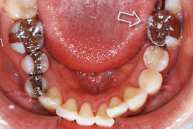 治療前プレビュー