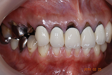 治療前プレビュー