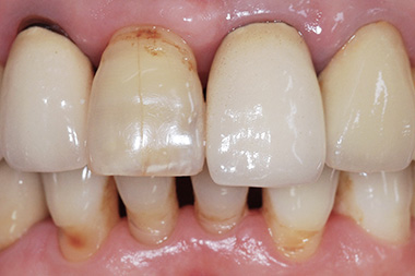 治療前プレビュー