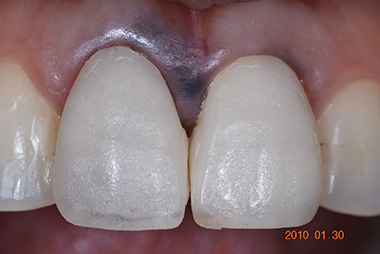 治療前プレビュー