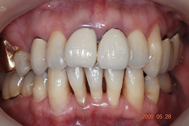 治療前プレビュー